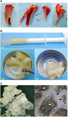 An Extrudable Partially Demineralized Allogeneic Bone Paste Exhibits a Similar Bone Healing Capacity as the “Gold Standard” Bone Graft